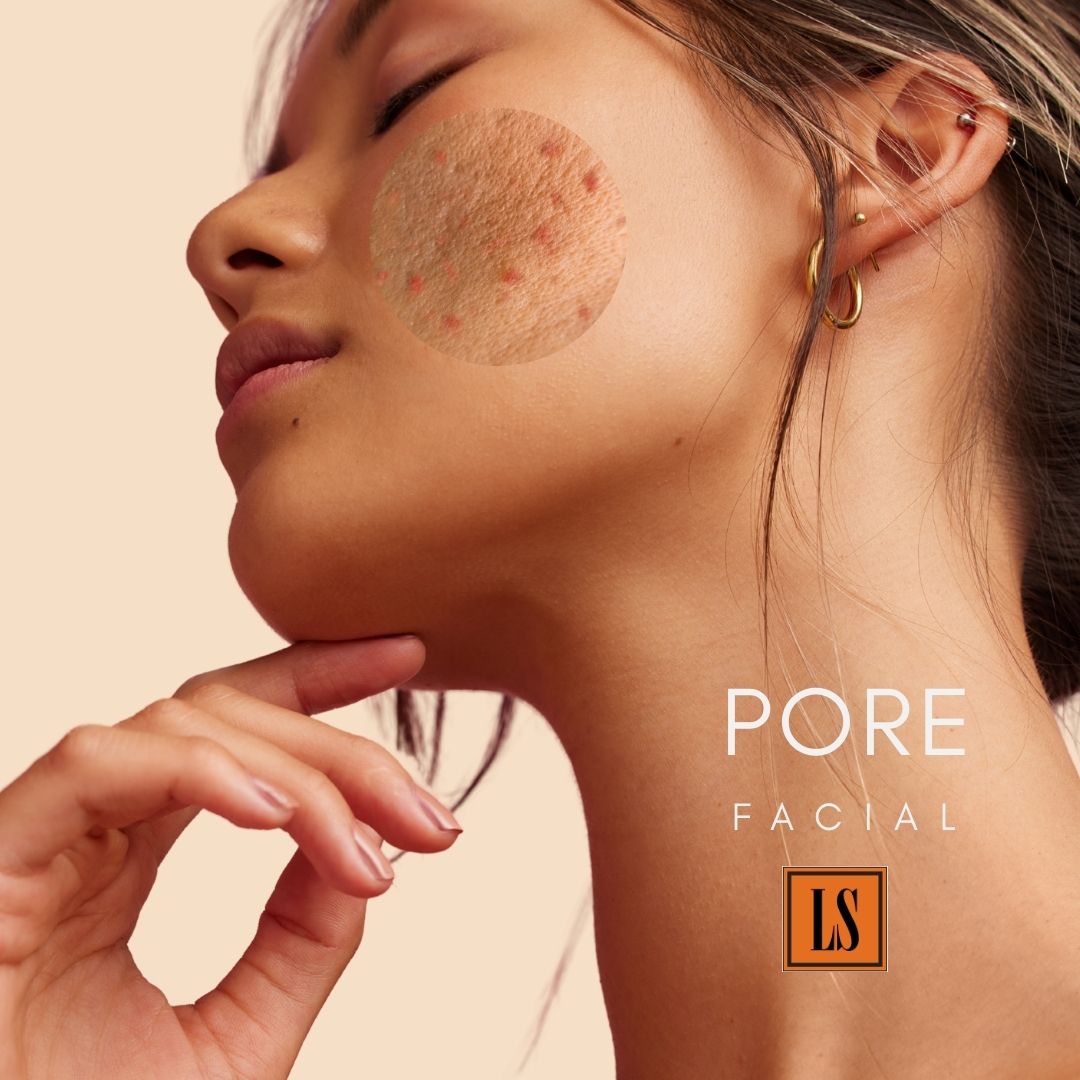 [S190030-90] PORE Facial Treatment (Target: oily acne-prone skin, enlarged pores, dull skin, & acne)