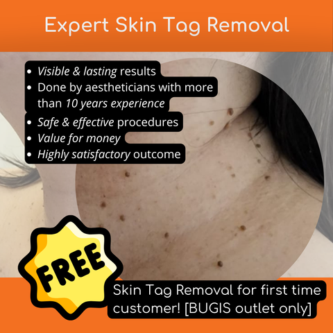 Skin Tag Removal