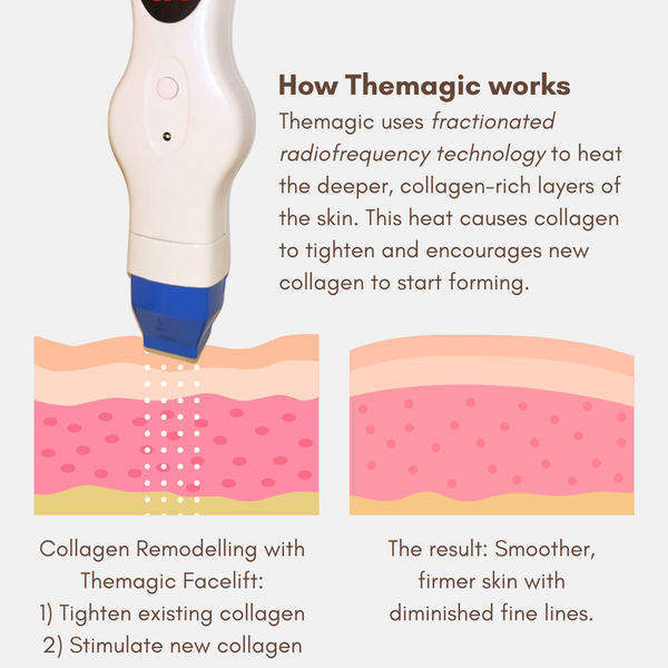 Themagic Face Treatment Plan- 6 Intensive Skin Tightening Treatments: Tighten, Lift, and Transform your skin FREE Collagen Volume Ampoule