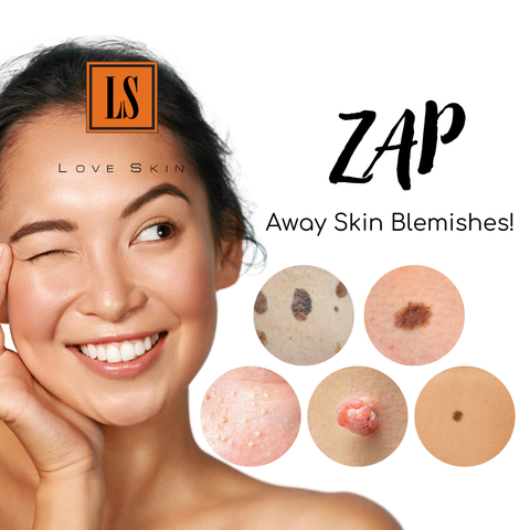 [S190054-10] Zap Away Skin BLEMISHES! Say Good bye to Seborrheic keratosis, Solar Lentigo (aka Liver spots/ Age spots), Milia seeds (aka Oil seeds), Skin Tags, and Moles