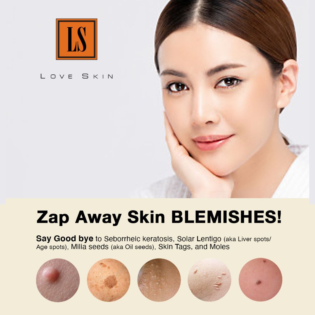 [S190054A][ALA CARTE, Minimum $30] Zap Away Skin BLEMISHES! Say Good bye to Seborrheic keratosis, Solar Lentigo (aka Liver spots/ Age spots), Milia seeds (aka Oil seeds), Skin Tags, and Moles