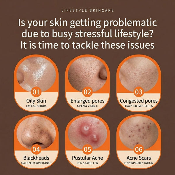 [S190011 - 90] Acne Clearance Facial Treatment - EFFECTIVE WAY to clear STUBBORN ACNE!