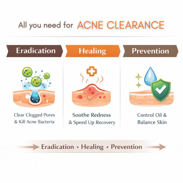 [S190011 - 90] Acne Clearance Facial Treatment - EFFECTIVE WAY to clear STUBBORN ACNE!