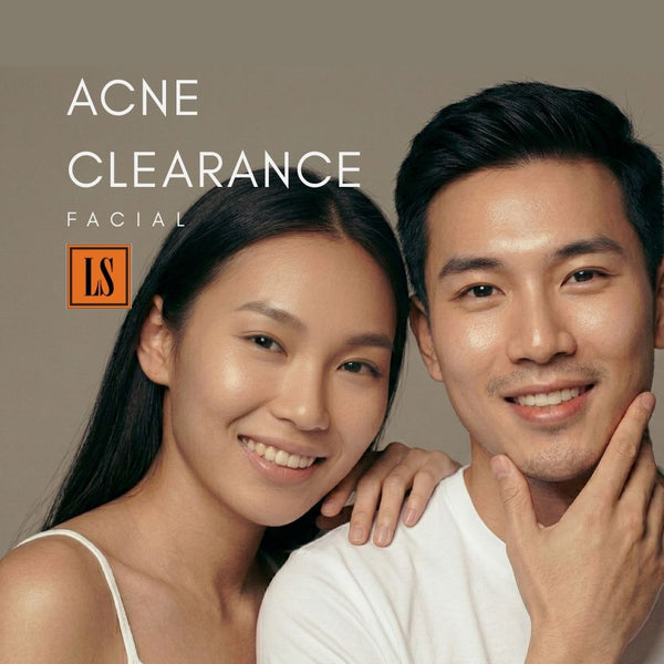 [S190011 - 90] Acne Clearance Facial Treatment - EFFECTIVE WAY to clear STUBBORN ACNE!