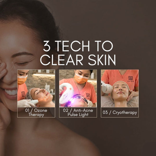 [S190011 - 90] Acne Clearance Facial Treatment - EFFECTIVE WAY to clear STUBBORN ACNE!