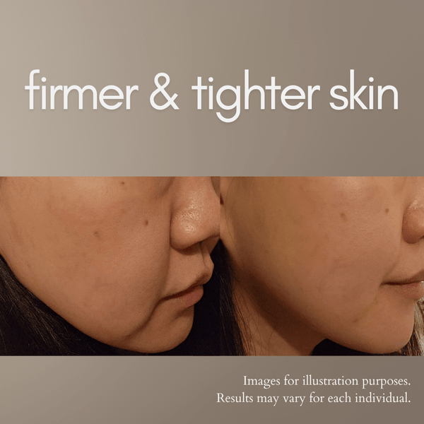 Themagic Face Treatment Plan - 6 Intensive Skin Tightening Treatments: Tighten, Lift, and Transform your skin FREE 3 Anti - aging Serums