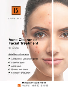 [S190011-90] Acne Clearance Facial Treatment - EFFECTIVE WAY to clear STUBBORN ACNE!