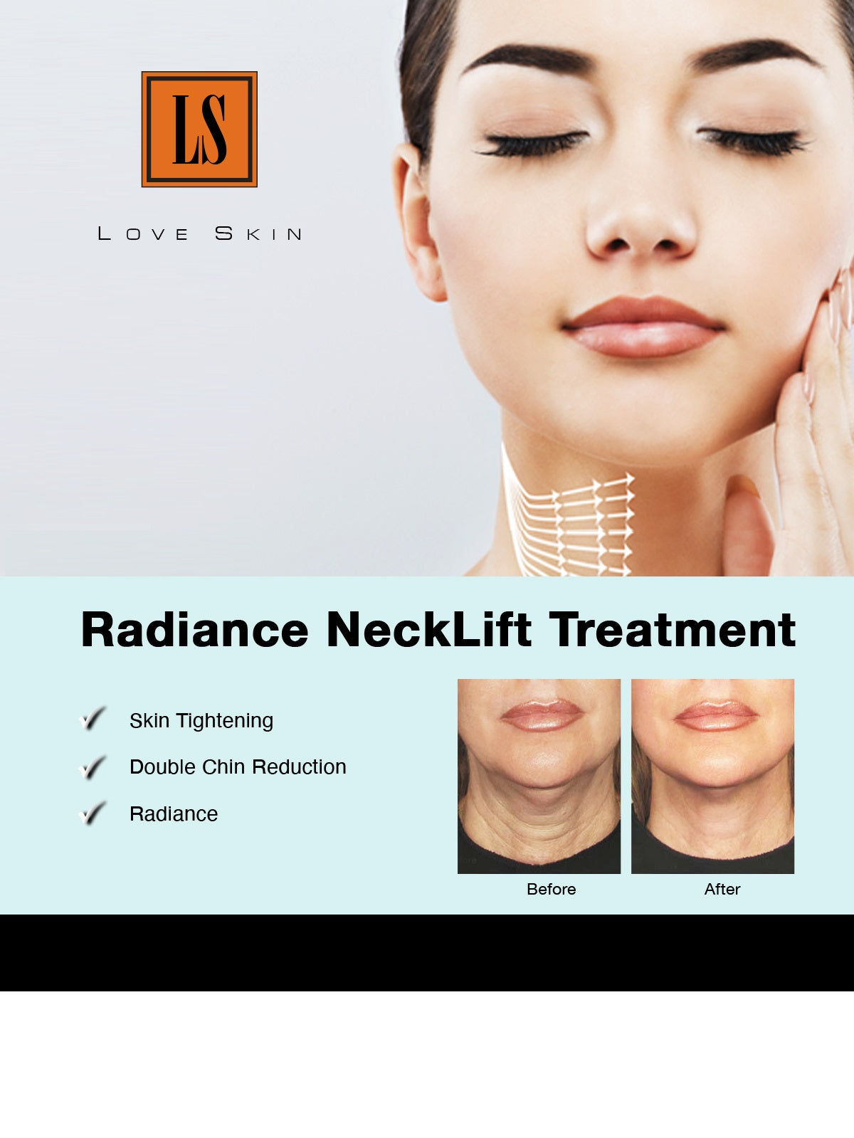 [S190022-30] Radiance NeckLift Treatment