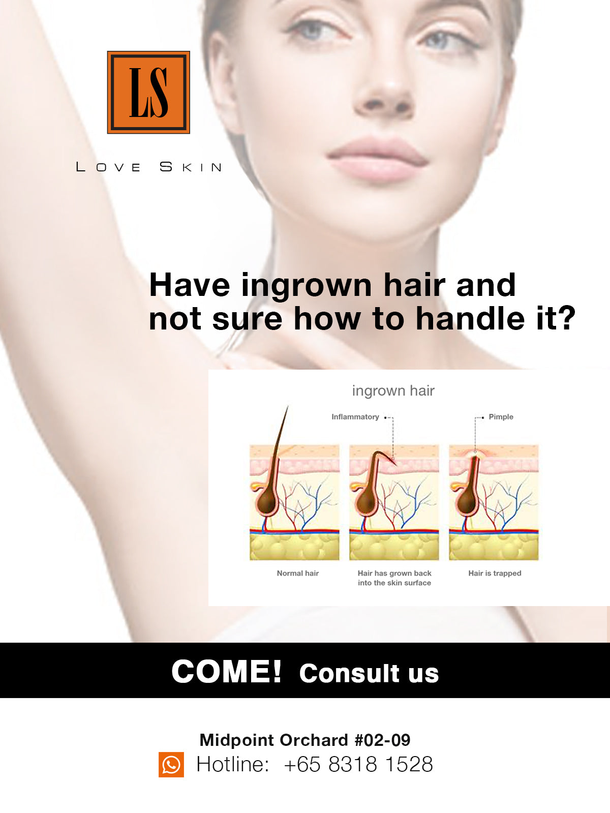 Underarm Ingrown Hair Extraction