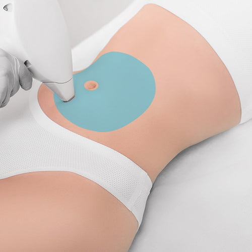 [S190049-15] Belly IPL Hair Removal – Say GOOD BYE to waxing and shaving!